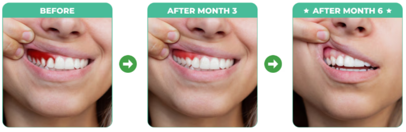 DentalPrime Customer review